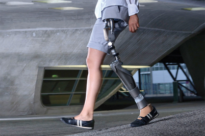 Hip joint prosthesis with iglidur® bearings by Otto Bock HealthCare GmbH